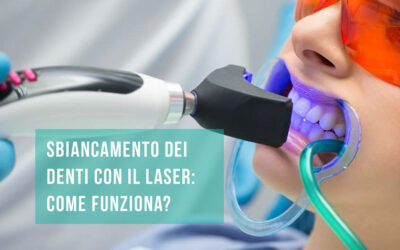 Sbiancamento denti laser: come funziona?